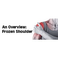 An Overview: Frozen Shoulder - South County Spine Care Center