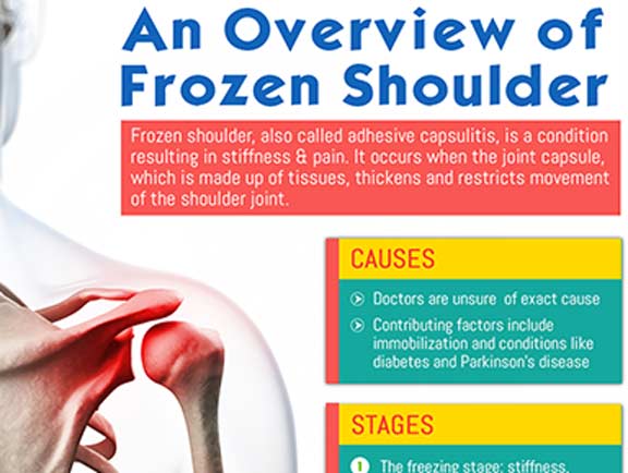 An-Overview-of-Frozen-Shoulder-South-County-Spine-Care