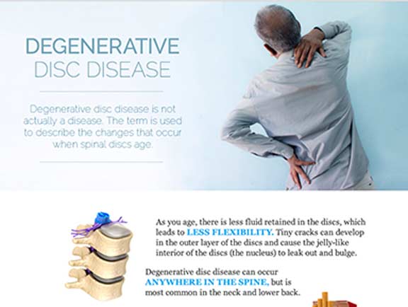 Degenerative-Disc-Disease-South-County-Spine-Care