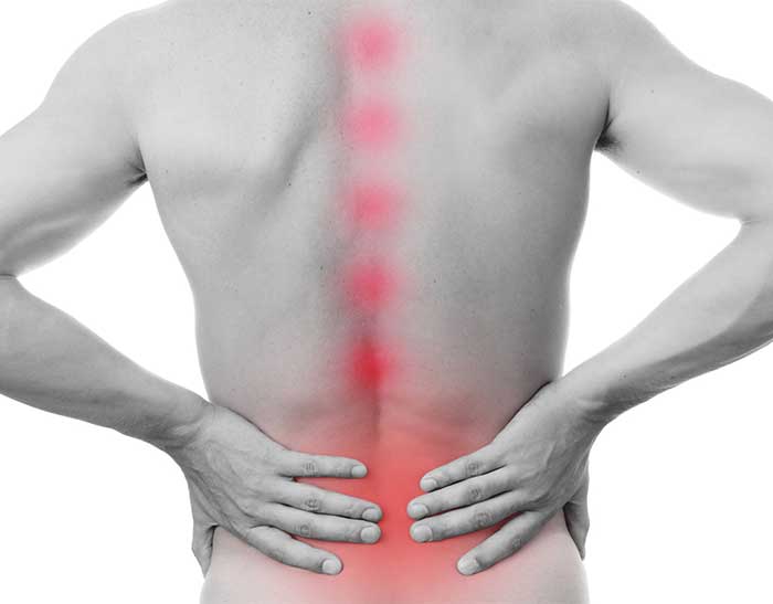 Epidural-Injections-South-County-Spine-Care