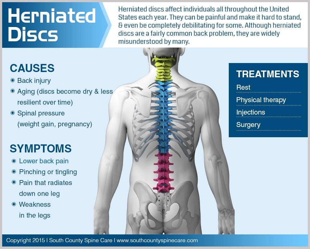 Herniated Discs - South County Spine Care