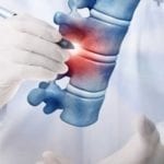 Invasive-vs.-Minimally-Invasive-Back-Surgery-South-County-Spine-Care