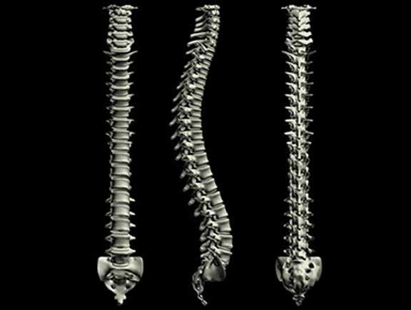 Minimally Invasive Spine Surgery - South County Spine Care
