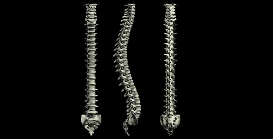 Minimally-Invasive-Spine-Surgery-Surgery-South-County-Spine-Care
