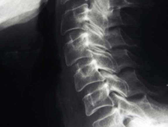 Pain Clinic Orange County - South County Spine Care