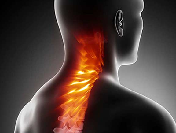 Ruptured Disc Treatment - South County Spine Care