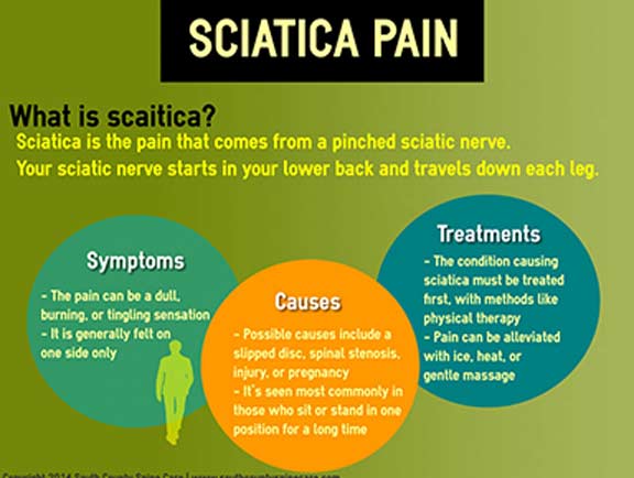 Sciatica Treatment  South County Spine Care - South County Spine