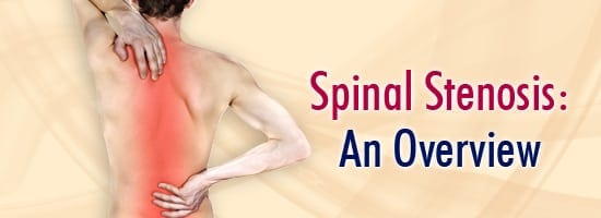 Spinal-Stenosis-An-Overview
