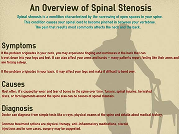 Spinal-Stenosis-South-County-Spine-Care