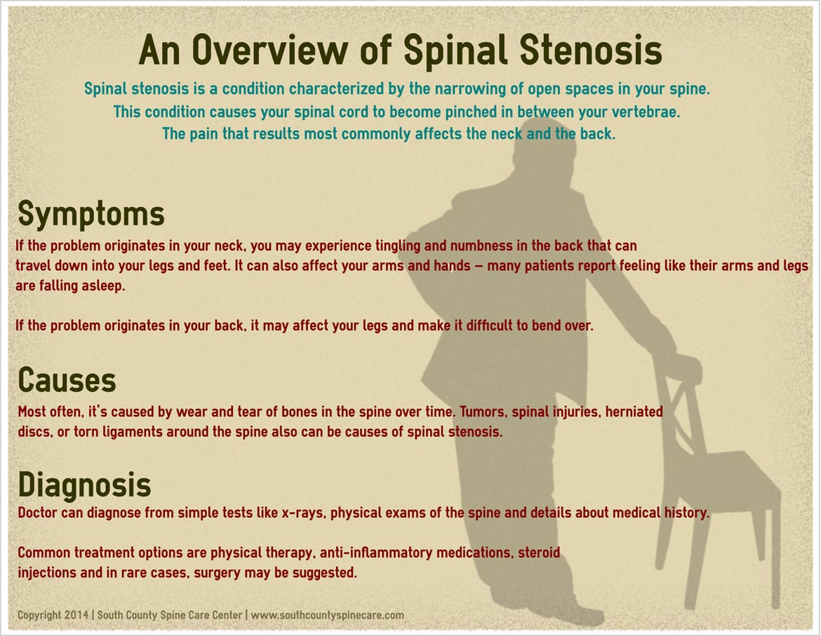 Spinal Stenosis - South County Spine Care