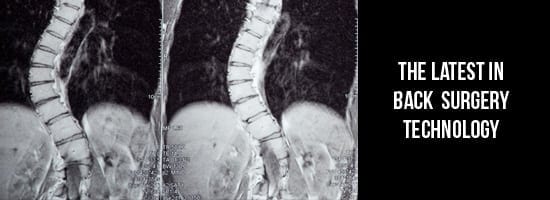 The-Latest-in-Back-Surgery-Technology-South-County-Spine-Care