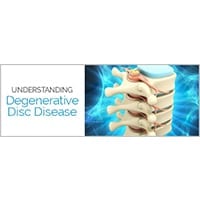 stem cell treatment for degenerative disc disease reviews