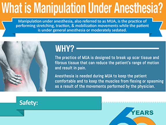 What-is-Manipulation-Under-Anesthesia-South-County-Spine-Care