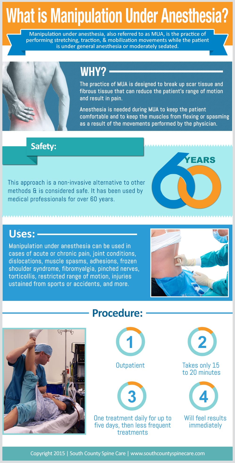 What is Manipulation Under Anesthesia - South County Spine Care