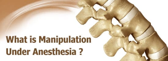 What-is-Manipulation-Under-Anesthesia