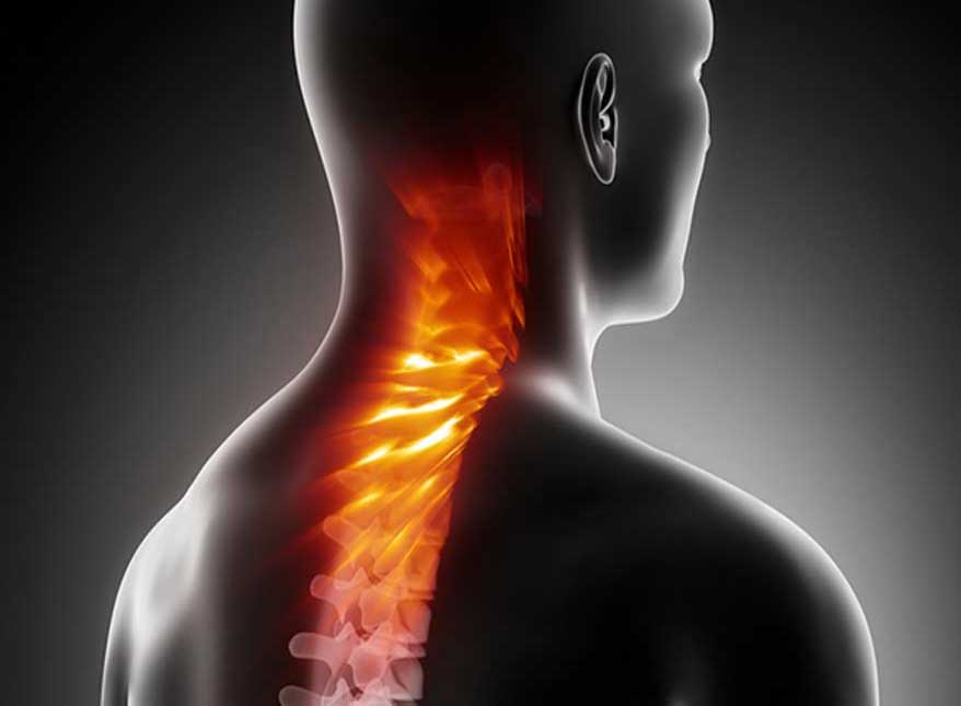 Ruptured-Disc-Treatment-CA-South-County-Spine-Care